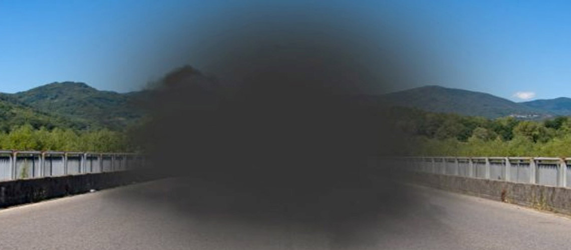 AGE-RELATED MACULAR DEGENERATION