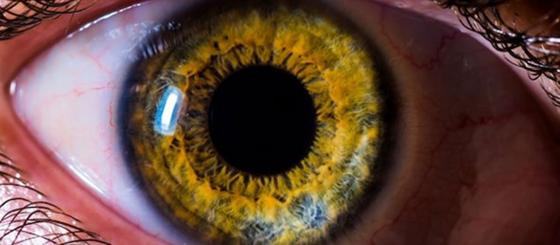 
			
WINDOW TO THE SOUL AND BRAIN
			
		